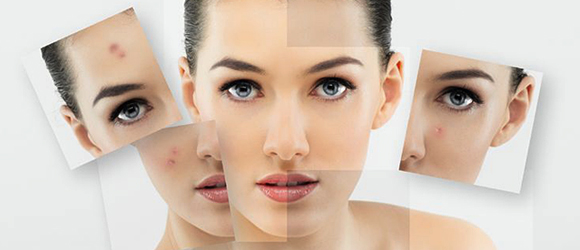 Know The Effectiveness In The Laser Acne Scar Removal Treatments