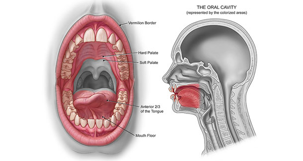 Everything You Should Know About Oral Cancer